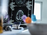 Escaneos cerebrales que se muestran en una pantalla - foto de stock
