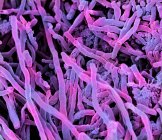 Streptomyces coelicoflavus Bakterien — Stockfoto