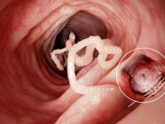 Tapeworm in human intestine — Stock Photo