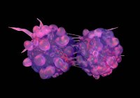 Morfología celular del cáncer - foto de stock