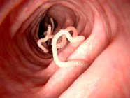 Bandwurm im menschlichen Darm — Stockfoto