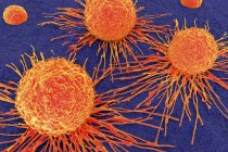 Morphologie des cellules cancéreuses — Photo de stock
