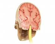 Coupe transversale du cerveau et du crâne humains — Photo de stock