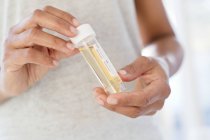 Woman holding urine sample — Stock Photo