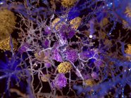 Ilustración por ordenador de placas amiloides (amarillas) entre neuronas
. - foto de stock