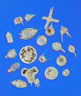Micrographie différentielle du contraste d'interférence de différentes espèces de radiolaires unicellulaires fossiles (protozoaires)
). — Photo de stock