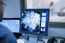 Doctor looking at MRI scans on monitor. — Stock Photo
