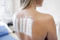 Female patient undergoing patch test in allergy clinic. — Stock Photo