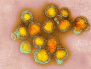 Micrographie des particules du virus de la grippe H3N2
. — Photo de stock