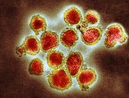 Micrografia das partículas do vírus da gripe H3N2
. — Fotografia de Stock