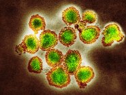Micrografico delle particelle del virus influenzale H3N2 . — Foto stock