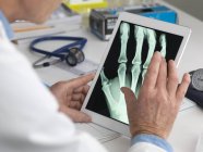 Doctor viendo rayos X de la mano en la tableta digital . - foto de stock
