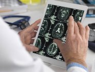 Arzt sieht Gehirnscans auf digitalem Tablet. — Stockfoto