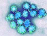 Micrografía de las partículas del virus de la gripe H3N2
. - foto de stock