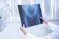 Les mains du médecin tenant une radiographie du bassin humain . — Photo de stock