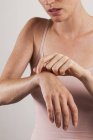 Close-up of woman scratching itchy arm. — Stock Photo