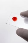 Un scientifique tient un échantillon de goutte de sang sur une lame de microscope, prise de vue en studio . — Photo de stock