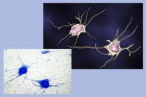 Ilustração digital das células dos neurônios nervosos . — Fotografia de Stock
