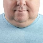 Primo piano del mento e del collo dell'uomo sovrappeso, ritagliato — Foto stock