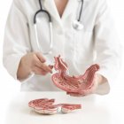Doctor with medical model of human stomach with gastric band. — Stock Photo