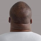 Крупним планом надмірна вага шиї людини, вид ззаду . — стокове фото
