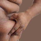 Uomo sovrappeso pizzicando corpo in vita, primo piano . — Foto stock
