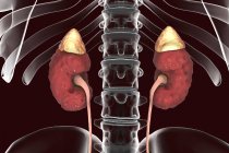 Digital illustration of gross anatomy of kidneys with chronic glomerulonephritis. — Stock Photo