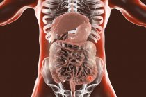 Cancro al colon nel corpo umano, illustrazione digitale . — Foto stock