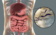 Digital illustration of Helicobacter pylori bacteria in human stomach. — Stock Photo