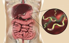 Illustration numérique de la bactérie Helicobacter pylori dans l'estomac humain . — Photo de stock