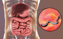 Digitale Illustration von Helicobacter pylori Bakterien im menschlichen Magen. — Stockfoto