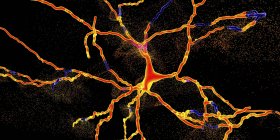 Illustration conceptuelle de la dégénérescence des neurones dopaminergiques . — Photo de stock