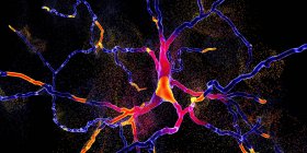Ilustración conceptual de la degeneración de neuronas dopaminérgicas . - foto de stock