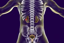 Ilustração digital do corpo humano com câncer de rins . — Fotografia de Stock