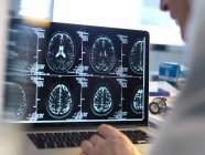 Médico vendo varreduras cerebrais na tela do computador . — Fotografia de Stock