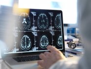 Doctor viewing brain scans on computer screen. — Stock Photo