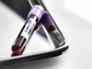 Tube with blood sample on metal tray in laboratory, close-up. — Stock Photo