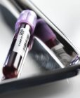 Tubo con muestra de sangre en bandeja metálica en laboratorio, primer plano
. - foto de stock