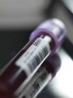 Tubo com amostra de sangue em bandeja de metal em laboratório, close-up
. — Fotografia de Stock