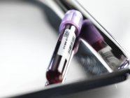 Tubo com amostra de sangue em bandeja de metal em laboratório, close-up . — Fotografia de Stock