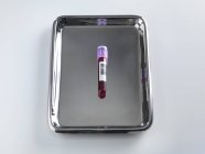 Tubo con muestra de sangre en bandeja metálica en laboratorio . - foto de stock