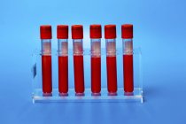 Rack of test tubes with blood samples on blue background. — Stock Photo