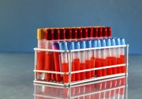 Regal mit Reagenzgläsern mit Blutproben im Labor. — Stockfoto