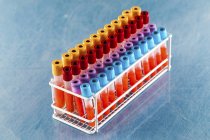 Rack of test tubes with blood samples in laboratory. — Stock Photo