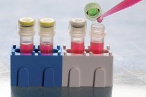 Close-up de pipetagem de pipeta em tubos de ensaio em laboratório patogénico . — Fotografia de Stock