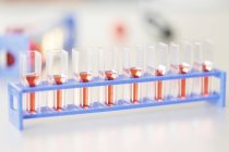 Close-up of rack of cell cultures in tubes in laboratory. — Stock Photo