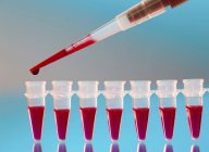 Close-up de micropipeta pipetagem amostra de sangue em tubos de microcentrifugação . — Fotografia de Stock