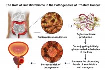 Ilustración conceptual de la asociación de la bacteria Bacteroides massiliensis en el intestino con el desarrollo de cáncer de próstata
. - foto de stock