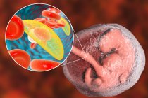 Эмбрион человека и крупный план паразитов Toxoplasma gondii, концептуальная иллюстрация . — стоковое фото