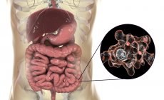 Close-up of parasitic amoeba in human intestine, digital artwork. — Stock Photo